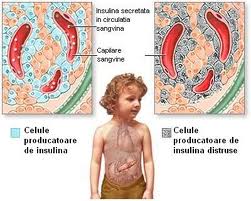 DIABETUL – SE POATE TRĂI  ÎMPREUNĂ CU EL?